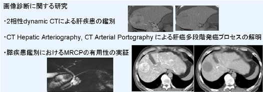 画像診断に関する研究