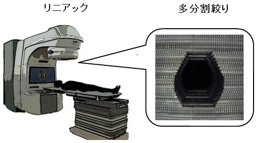 リニアック