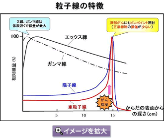 粒子線の特徴